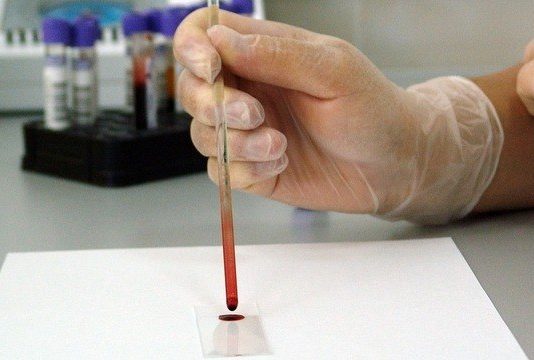 Doença desconhecida causa morte em Minas Gerais