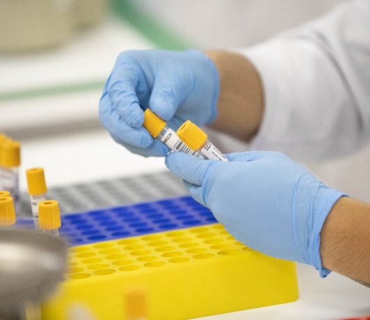 Centro de Contingência alerta sobre dispersão do coronavírus no interior de SP