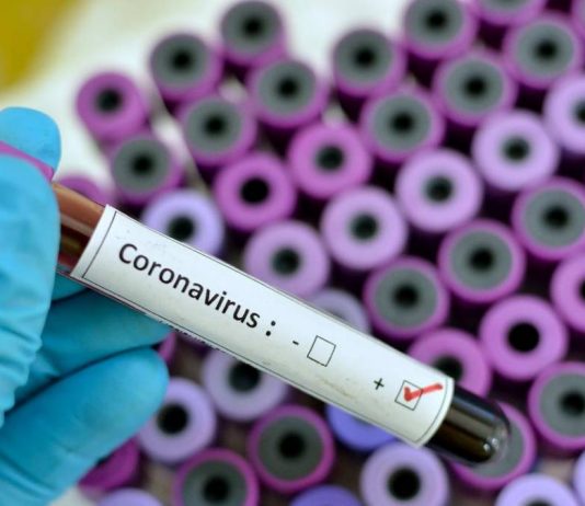 Mirassol registrou 68 casos e um óbito por Covid-19 nesta quinta-feira (20)